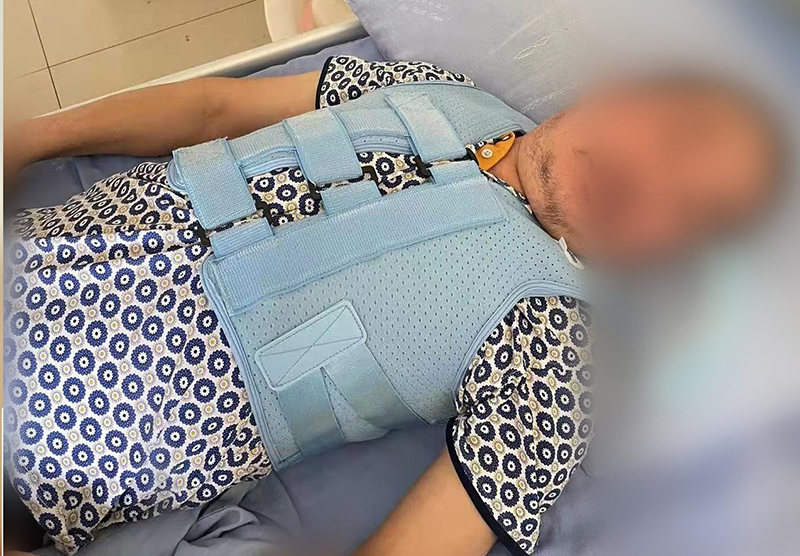 四川資陽(yáng)骨科醫(yī)院 胸腰椎固定支具