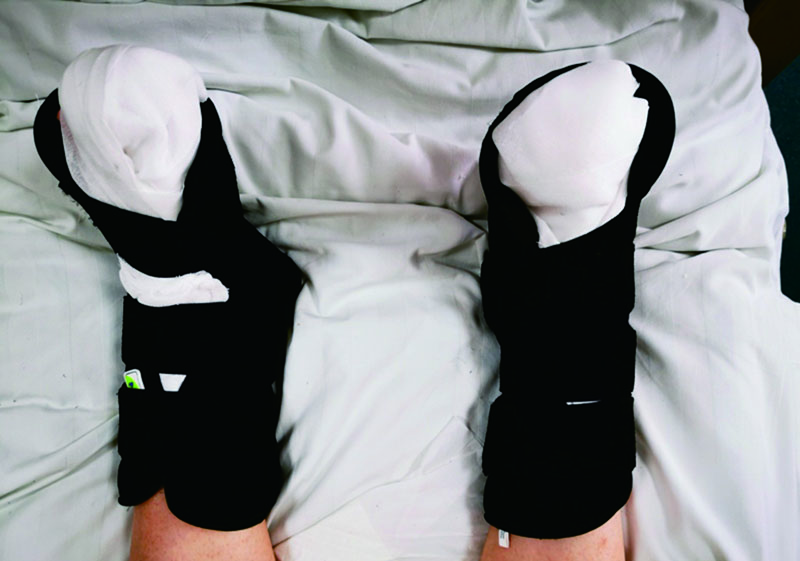 曲靖市第一人民醫(yī)院-足踝固定支具